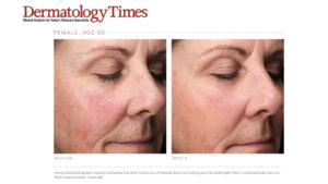 DermatologyTimes®: A solution for estrogen-deficient skin